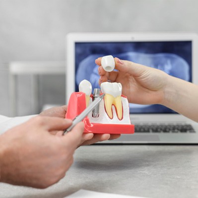 a dentist showing a patient a dental implant model